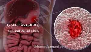 نزيف المعدة المفاجئ: خطر النزيف الصامت