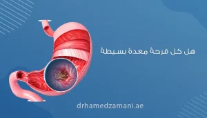 هل كل قرحة معدة بسيطة