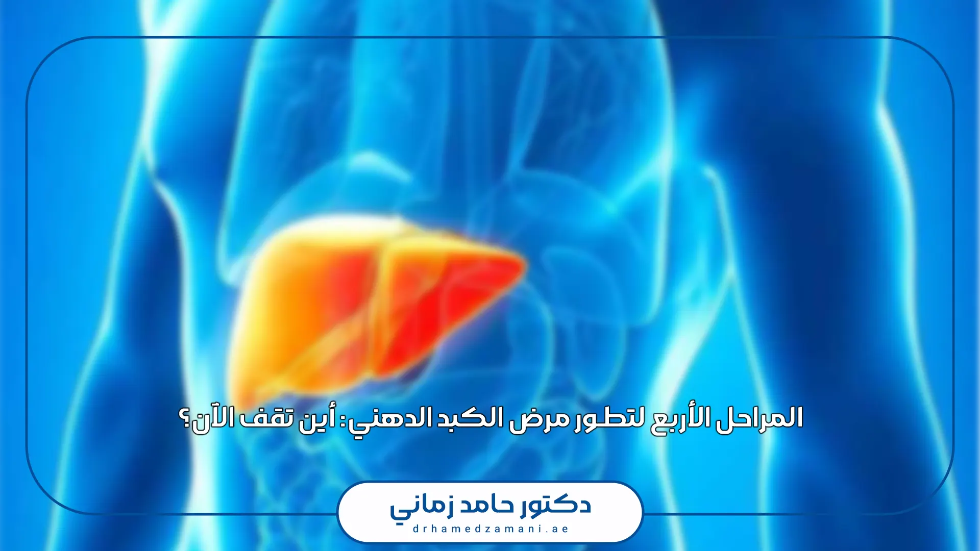 المراحل الأربع لتطور مرض الكبد الدهني: أين تقف الآن؟