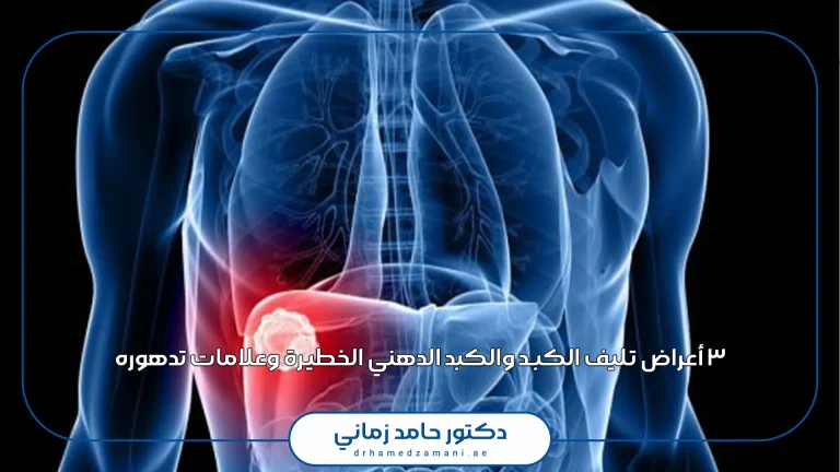 ٣ أعراض تليف الكبد والكبد الدهني الخطيرة وعلامات تدهوره